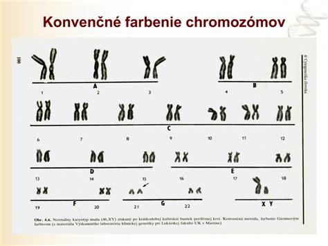 schematické znázornenie chromozómov a pohlavných znakov