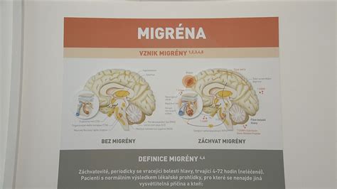 Prehľad bezpečnosti liekov na migrénu v tehotenstve