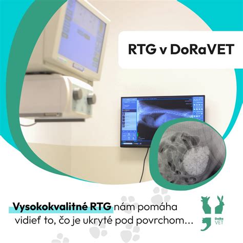 Röntgenové vyšetrenie hysterosalpingografia (HSG)