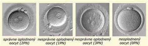 Kultivácia embryí v laboratóriu