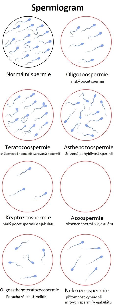 Prehľad typov spermií a ich kvality