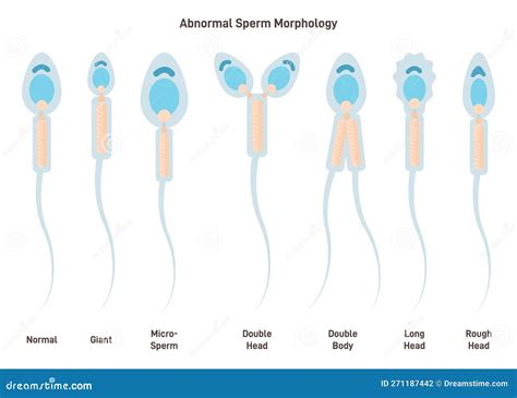 Diagram zobrazujúci pohyb spermií