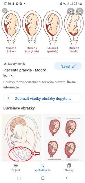 Diagram pôrodných fáz