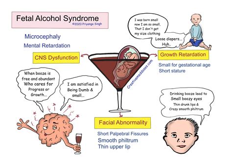 Diagram: A visual representation of the FASD spectrum, illustrating the range of severity from mild cognitive issues to the full-blown Fetal Alcohol Syndrome.