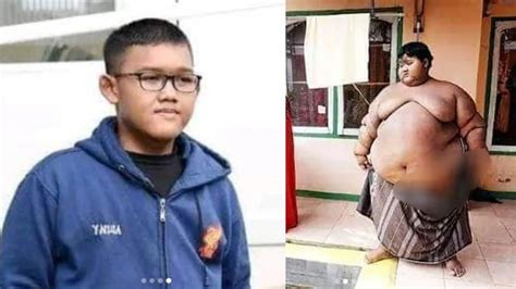 Arya Permana po schudnutí