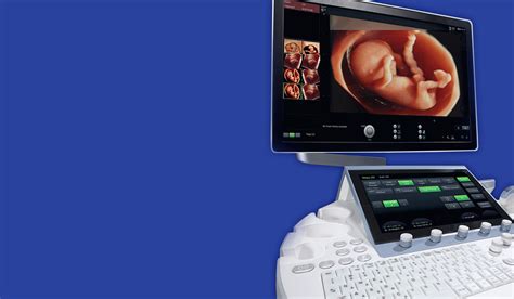 Moderné vybavenie prenatálnej diagnostiky