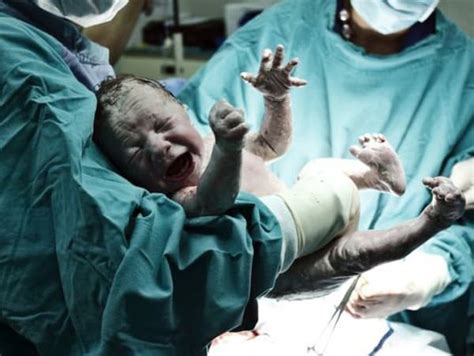Dieťa v neporušenom plodovom vaku po cisárskom reze