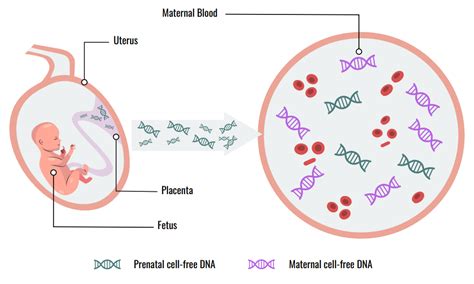 Infografika: Chromozómové abnormality detegované NIPT