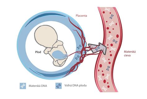 Schéma pôvodu a detekcie voľnej fetálnej DNA v matkinej krvi