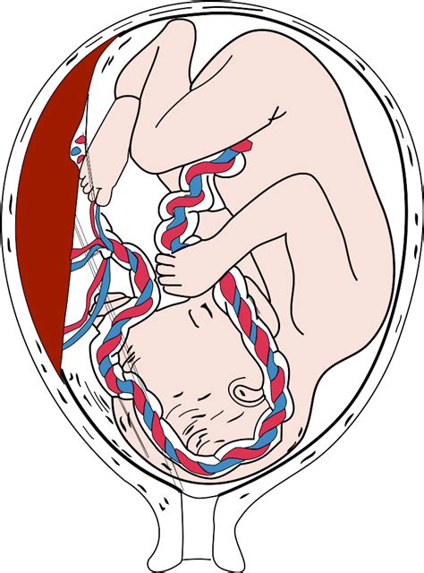 Placenta a pupočníková šnúra