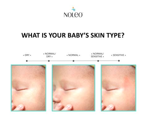 illustration of baby with sensitive skin