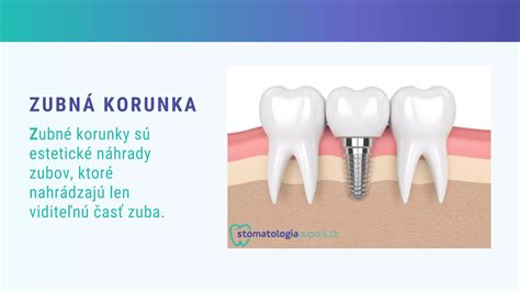Kompozitná výplň vs. zubná korunka
