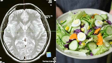 obrázok znázorňujúci spojenie medzi duševnou pohodou a fyzickým zdravím