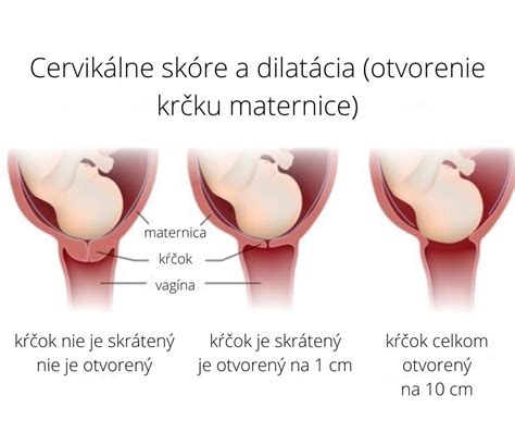 Ultrazvukový prístroj zobrazujúci krčok maternice
