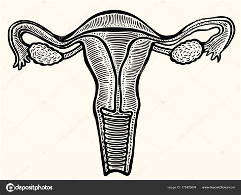 Ilustrácia endometriózy a jej vplyvu na vaječníky a okolité orgány