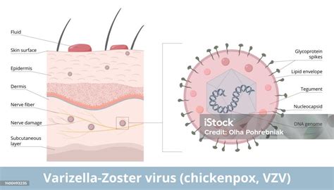 ilustrácia vírusu varicella zoster pod mikroskopom
