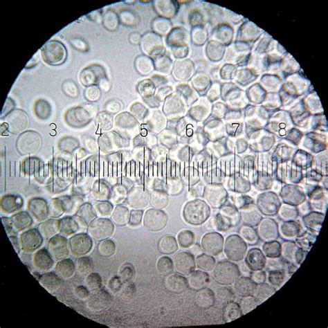 Pivovarské kvasnice Saccharomyces cerevisiae pod mikroskopom