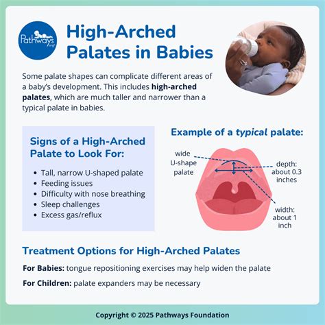 Diagram showing orthodontic pacifier design and how it reduces pressure on palate