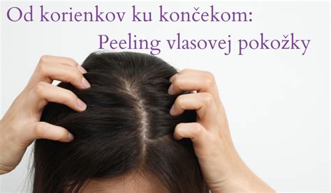 Správna technika masáže vlasovej pokožky