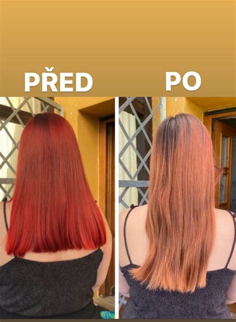 Pevné a zdravé vlasy vďaka placentovým ampulkám