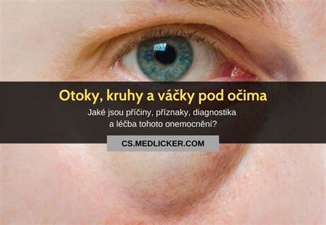 Unavené oči a kruhy pod nimi