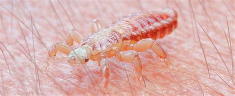 Ilustrácia znázorňujúca vši a hnidy