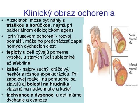 graf znázorňujúci kapacitu pľúc pri respiračných ochoreniach