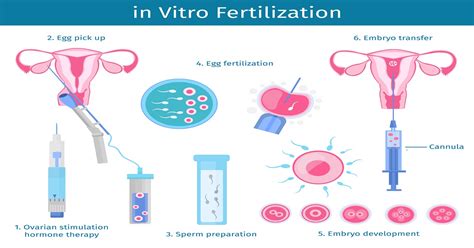 Legislatívne podmienky IVF