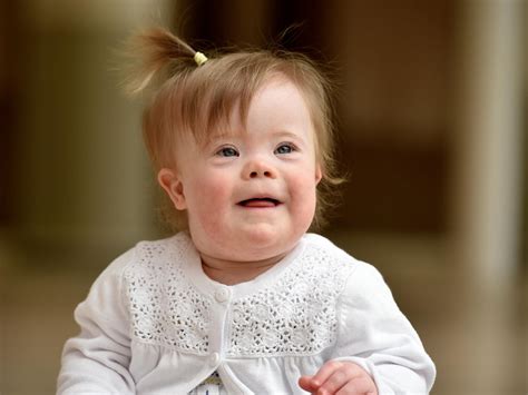 Dieťa s Downovým syndrómom pozerá na obrázkové kartičky