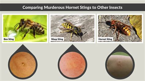 Infographic: How to distinguish bee, wasp and hornet stings