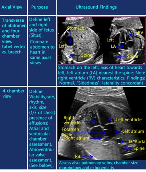 fetal heart ultrasound