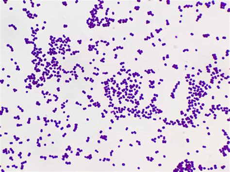 Mikroskopický obraz Staphylococcus aureus