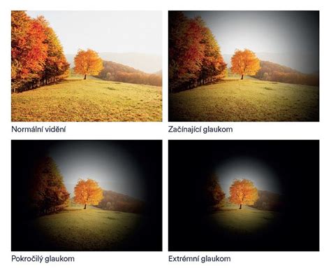 Rozmazané videnie na diaľku