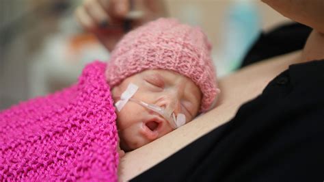 infografika znázorňujúca dôležitosť kontaktu koža na kožu pre predčasne narodené deti