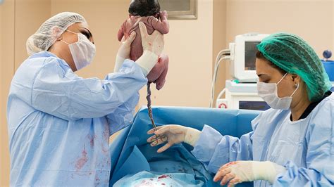 priebeh cisárskeho rezu