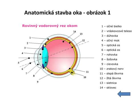 Schéma normálneho a škúliaceho oka, znázorňujúca nesúlad v smere pohľadu