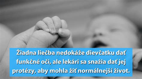 Dieťa, ktoré si šúcha oči