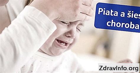 Alternatívne metódy liečby jačmeňa u detí