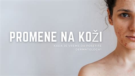 Schéma progresie syfilitických lézií na koži a slizniciach