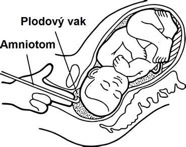 Plodová voda a vývoj orgánov