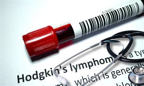 Rozdiel medzi Hodgkinovým a Non-Hodgkinovým lymfómom