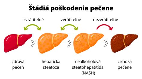 Porovnanie ultrazvukových obrazov zdravej pečene a pečene s tukovými zmenami