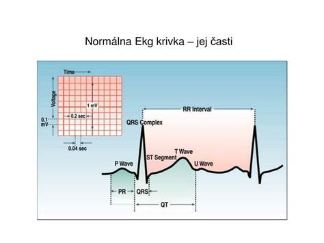 Interpretácia EKG krivky