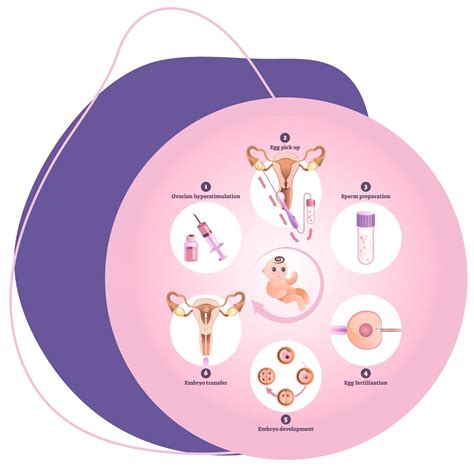 Schéma intrauterinnej inseminácie (IUI)