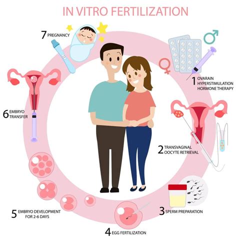 Priebeh mimotelového oplodnenia (IVF)