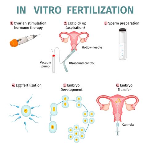 Diagram IVF postupu