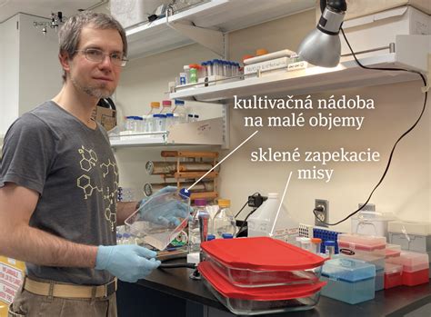 Zariadenia na kryoprezerváciu vajíčok v laboratóriu