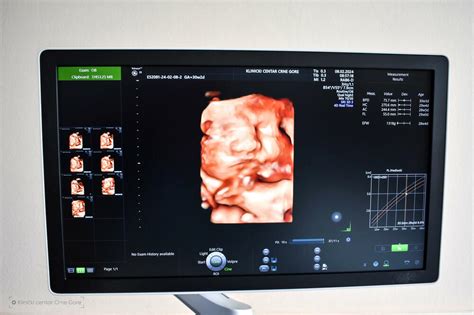 Cenník 3D ultrazvuku