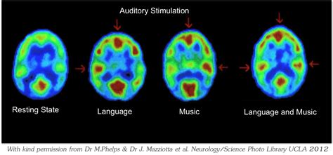 brain activity during music listening