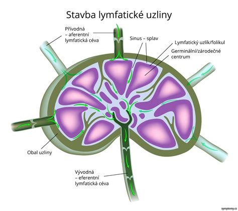 Zväčšené lymfatické uzliny ako príznak lymfocytózy